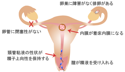 不妊症検査